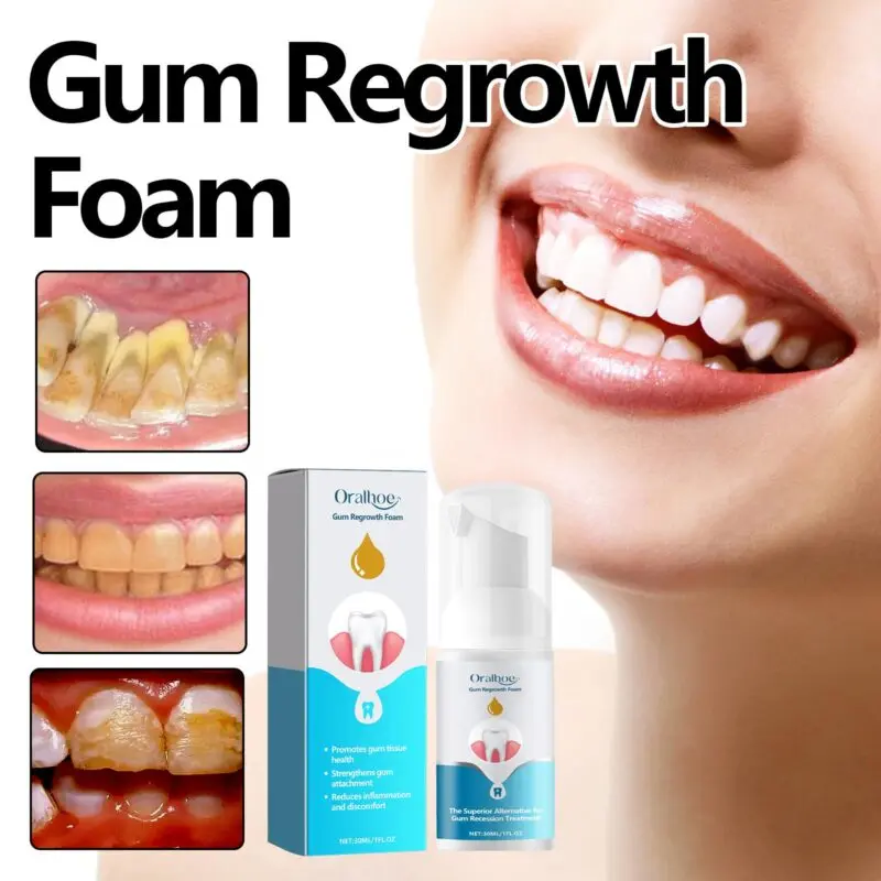 Oralhoe Gum Care Foam - Tartar Removal, Fresh Breath Oral Mousse - Image 3
