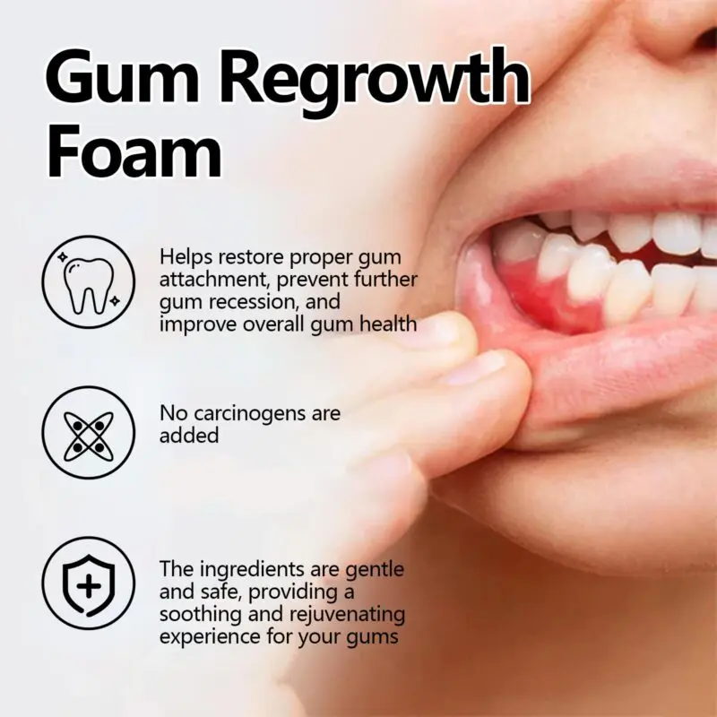 Oralhoe Gum Care Foam - Tartar Removal, Fresh Breath Oral Mousse - Image 4