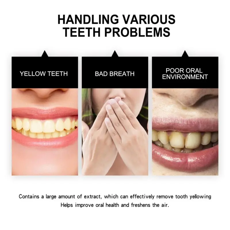 Oralhoe Teeth Whitening Powder - Stain Care & Oral Cleaning - Image 3