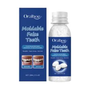 Oralhoe Solid Dental Glue: Temporary Dental Fillings for Teeth, Dentures & Fixation
