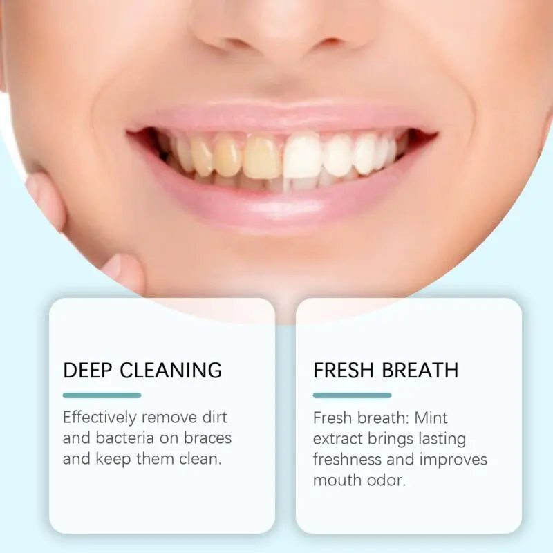 Oralhoe Braces Cleansing Mousse - Gentle Foam Cleaner for Orthodontic Appliances - Image 2