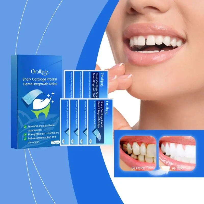 Oralhoe Dental Whitening Strips - Stain Removal for Teeth, Brightening Treatment - Image 2