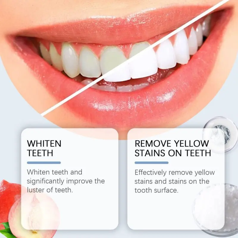 Oralhoe Niacinamide Toothpaste for whitening, enamel support, and gentle tartar removal