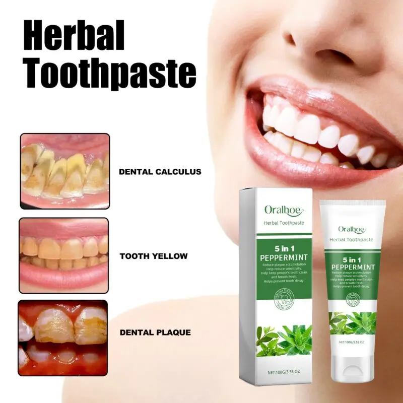 Oralhoe Aloe Whitening Toothpaste for Stain Removal and Fresh Breath - Image 3