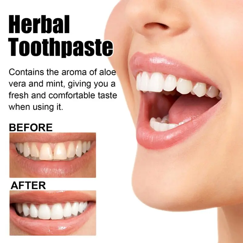 Oralhoe Aloe Whitening Toothpaste for Stain Removal and Fresh Breath - Image 4