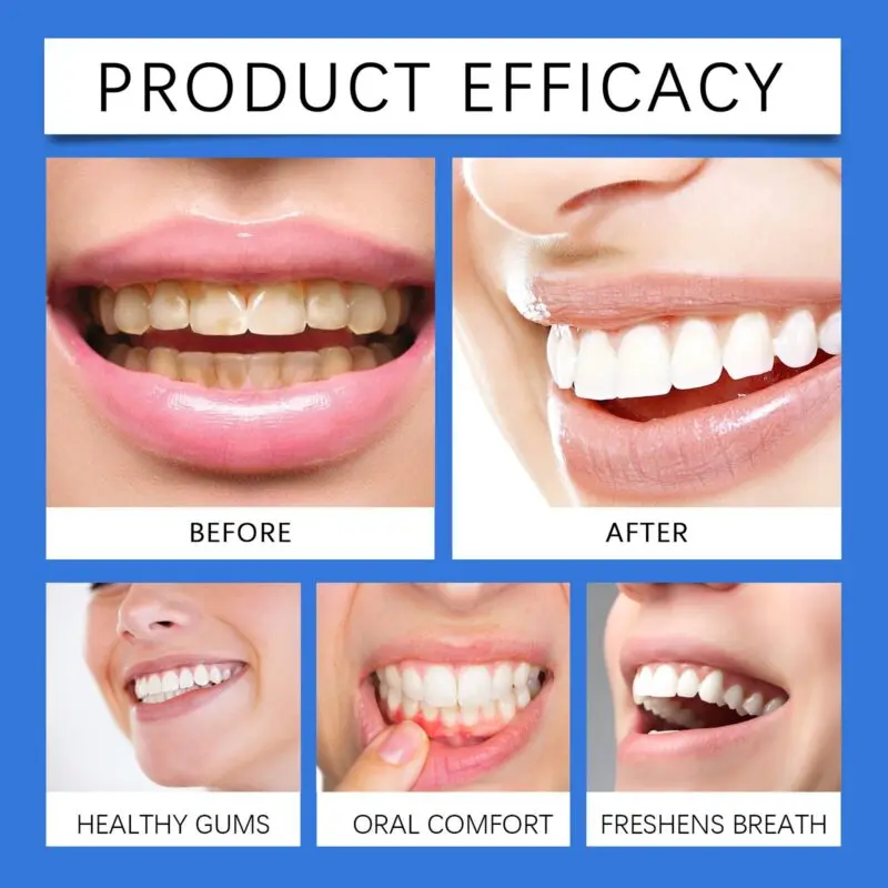 Oralhoe Propolis Oral Spray for Gum Protection, Stain Removal & Fresh Breath - Image 3